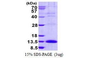 LSM2 Homolog, U6 Small Nuclear RNA Associated (LSM2) protein (His tag)