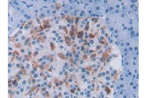 Immunohistochemistry (IHC) image for anti-Transferrin Receptor 2 (TFR2) (AA 4-87) antibody (ABIN7431464)