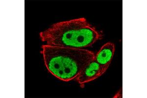 Immunofluorescent staining of human cell line PC-3 with RARG polyclonal antibody  at 1-4 ug/mL concentration shows positivity in nucleus but excluded from the nucleoli. (Retinoic Acid Receptor gamma 抗体)