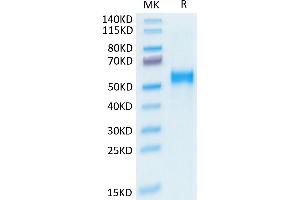 Human Kremen-2 on Tris-Bis PAGE under reduced condition. (KREMEN2 Protein (AA 26-364) (His tag))