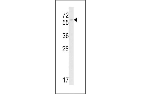 FKBP9 抗体  (C-Term)