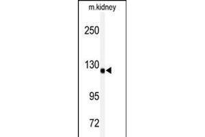 Western blot analysis of anti-ADTS19 Antibody (Center) (ABIN391653 and ABIN2841562) in mouse kidney tissue lysates (35 μg/lane). (ADAMTS19 抗体  (AA 298-328))