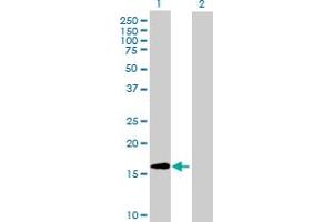 Western Blot analysis of CLUHP3 expression in transfected 293T cell line ( H00079014-T02 ) by CLUHP3 MaxPab polyclonal antibody. (CLUHP3 抗体  (AA 1-147))