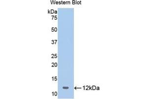 Western blot analysis of the recombinant protein. (OAS1 抗体  (AA 74-165))