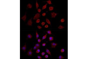 Immunofluorescence analysis of A-549 cells using MMP7 Rabbit pAb (ABIN3021102, ABIN3021103, ABIN3021104, ABIN1513214 and ABIN6213952) at dilution of 1:350 (40x lens). (MMP7 抗体  (AA 18-267))