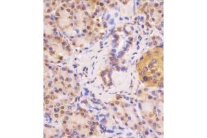 Immunohistochemistry (Paraffin-embedded Sections) (IHC (p)) image for anti-Von Hippel-Lindau Tumor Suppressor, E3 Ubiquitin Protein Ligase (VHL) (AA 43-71), (N-Term) antibody (ABIN390462)