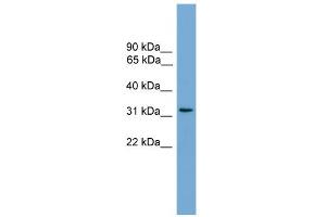 WB Suggested Anti-CCDC117 Antibody Titration: 0. (CCDC117 抗体  (Middle Region))
