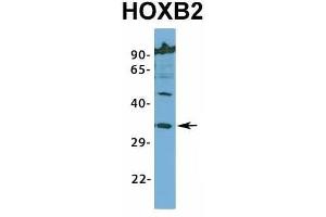 Host:  Rabbit  Target Name:  HOXB2  Sample Type:  Jurkat  Antibody Dilution:  1. (HOXB2 抗体  (N-Term))