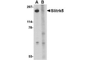 Image no. 1 for anti-SLIT and NTRK-Like Family, Member 5 (SLITRK5) (Internal Region) antibody (ABIN1493808) (SLITRK5 抗体  (Internal Region))