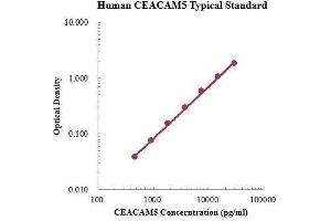 Carcinoembryonic Antigen-Related Cell Adhesion Molecule 5 (CEACAM5) ELISA Kit