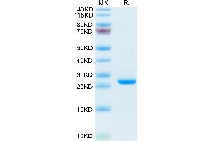 Mouse C-Reactive Protein/CRP on Tris-Bis PAGE under reduced condition. (CRP Protein (AA 20-225) (His tag))