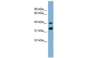 GPN2 antibody used at 1 ug/ml to detect target protein. (GPN2 抗体  (Middle Region))