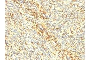 Formalin-fixed, paraffin-embedded human uterus stained with Transglutaminase 2 antibody. (Transglutaminase 2 抗体)