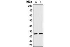 Western blot analysis of ACOT4 expression in RT4 (A), A549 (B) whole cell lysates. (ACOT4 抗体  (C-Term))