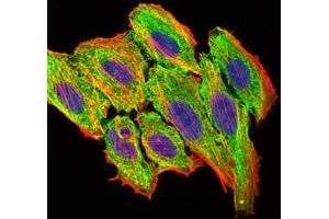 Immunofluorescence analysis of HepG2 cells using CCL2 mouse mAb (green).