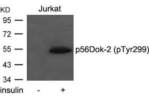 Western blot analysis of extracts from Jurkat cells untreated or treated with insulin using p56Dok-2(Phospho-Tyr299) Antibody. (DOK2 抗体  (pTyr299))