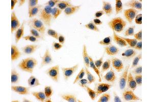 Anti-DCI antibody, ICC ICC: HELA Cell (DCI 抗体  (C-Term))