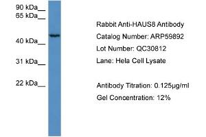 WB Suggested Anti-HAUS8  Antibody Titration: 0. (NYS48/HAUS8 抗体  (N-Term))