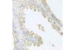 Immunohistochemistry of paraffin-embedded human prostate using PPP3R1 antibody at dilution of 1:100 (x40 lens). (PPP3R1 抗体)