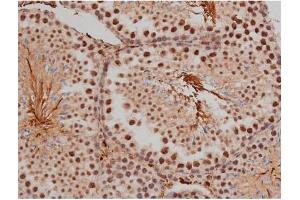 ABIN6267333 at 1/200 staining Mouse testis tissue sections by IHC-P. (SP1 抗体  (pThr453))