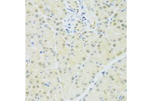 Immunohistochemistry of paraffin-embedded rat pancreas using BRCA1 antibody (ABIN6291827) at dilution of 1:100 (40x lens). (BRCA1 抗体)
