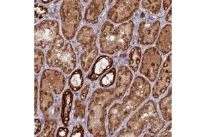 Immunohistochemical staining of human kidney with MPV17L polyclonal antibody  shows strong cytoplasmic positivity in tubular cells. (MPV17L 抗体)