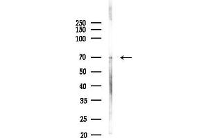 Western blot analysis of lysates from A2780 cells(starvation, 24h treatment), using Phospho-Synapsin I (Ser62/Ser67) Antibody at 1/1000 dilution.