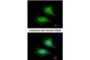 ICC/IF Image Immunofluorescence analysis of methanol-fixed HeLa, using LZTFL1, antibody at 1:200 dilution. (LZTFL1 抗体)