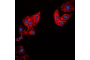 Immunofluorescent analysis of Collagen 5 alpha 1 staining in HeLa cells. (COL5A1 抗体  (Center))