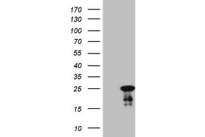 Western Blotting (WB) image for anti-ATP-Binding Cassette, Sub-Family C (CFTR/MRP), Member 5 (ABCC5) antibody (ABIN2715615) (ABCC5 抗体)