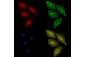 Phospho-MAP3K8/COT (Ser443) Antibody staining A549 cells(heat shock treatment) by IF/ICC. (MAP3K8 抗体  (pSer443))