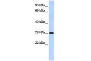 Image no. 1 for anti-Hydroxysteroid (17-Beta) Dehydrogenase 14 (HSD17B14) (C-Term) antibody (ABIN6741399)