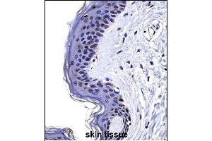 CSRP2 Antibody (Center) ((ABIN657989 and ABIN2846936))immunohistochemistry analysis in formalin fixed and paraffin embedded human skin tissue followed by peroxidase conjugation of the secondary antibody and DAB staining. (CSRP2 抗体  (AA 68-96))