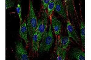Immunocytochemistry staining of Sos in human primary fibroblasts using anti-Sos (SOS-01, green). (Sos 抗体)