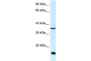 WB Suggested Anti-Klf3 Antibody   Titration: 1. (KLF3 抗体  (C-Term))