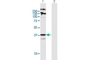 Western Blot analysis of ZDHHC23 expression in transfected 293T cell line by ZDHHC23 MaxPab polyclonal antibody. (ZDHHC23 抗体  (AA 1-409))