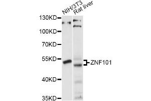 Western blot analysis of extracts of various cell lines, using ZNF101 antibody (ABIN6293896) at 1:1000 dilution. (ZNF101 抗体)