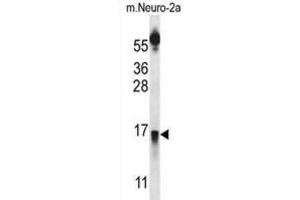 Western Blotting (WB) image for anti-Prolactin Releasing Hormone (PRLH) antibody (ABIN2997173)