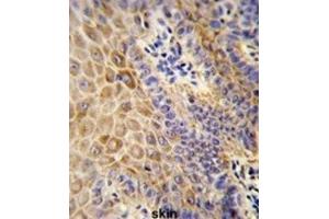 Immunohistochemistry (IHC) image for anti-Gc antibody (ABIN3003972) (Gc 抗体)