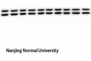 Western Blot (WB) analysis: Please contact us for more details. (ERK1/2 抗体  (pTyr204))