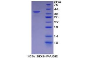 SDS-PAGE analysis of Mouse Neurofibromin 2 Protein. (Merlin 蛋白)