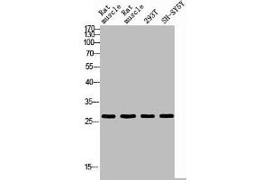Western blot analysis of RAT-MUSLE RAT-SPLEEN 293T SH-SY5Y using IL26 antibody. (IL-26 抗体  (Internal Region))