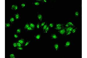 Immunofluorescent analysis of HepG2 cells using ABIN7143187 at dilution of 1:100 and Alexa Fluor 488-congugated AffiniPure Goat Anti-Rabbit IgG(H+L) (ACAD11 抗体  (AA 225-388))