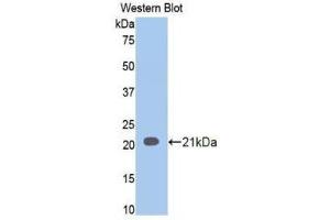 Western Blotting (WB) image for anti-Involucrin (IVL) (AA 6-156) antibody (ABIN1859461) (Involucrin 抗体  (AA 6-156))
