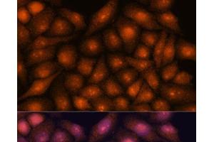 Immunofluorescence analysis of HeLa cells using DDX31 Polyclonal Antibody at dilution of 1:100. (DDX31 抗体)