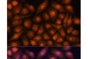 Immunofluorescence analysis of HeLa cells using DDX31 Polyclonal Antibody at dilution of 1:100. (DDX31 抗体)