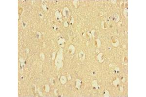 Immunohistochemistry of paraffin-embedded human brain tissue using ABIN7154647 at dilution of 1:100 (C9ORF72 抗体  (AA 138-430))