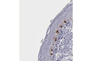 Immunohistochemical staining (Formalin-fixed paraffin-embedded sections) of human skin shows distinct cytoplasmic positivity in melanocytes with TYRP1 polyclonal antibody . (Tyrosinase-Related Protein 1 抗体  (AA 257-377))