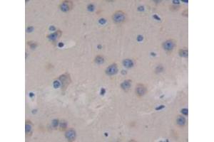 Used in DAB staining on fromalin fixed paraffin- embedded brain tissue (FBXL3 抗体  (AA 1-292))