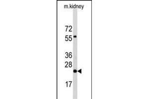 Western blot analysis of anti-PEMT Antibody (N-term) Pab (ABIN650614 and ABIN2844055) in mouse kidney tissue lysates (35 μg/lane). (PEMT 抗体  (N-Term))
